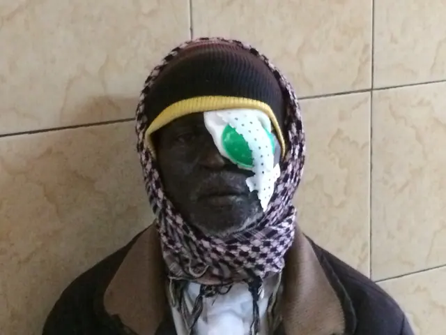 Portrait avec une protection oculaire — Burkina Faso · 2017